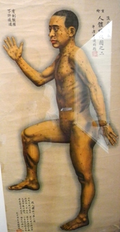artrosi